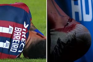 Adrian Bareiro sufrió un corte en su tobillo izquierdo, requirió seis puntos de sutura y fue reemplazado en el complemento
