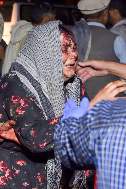 En fotos: impactantes imágenes de las explosiones cerca del aeropuerto de Kabul