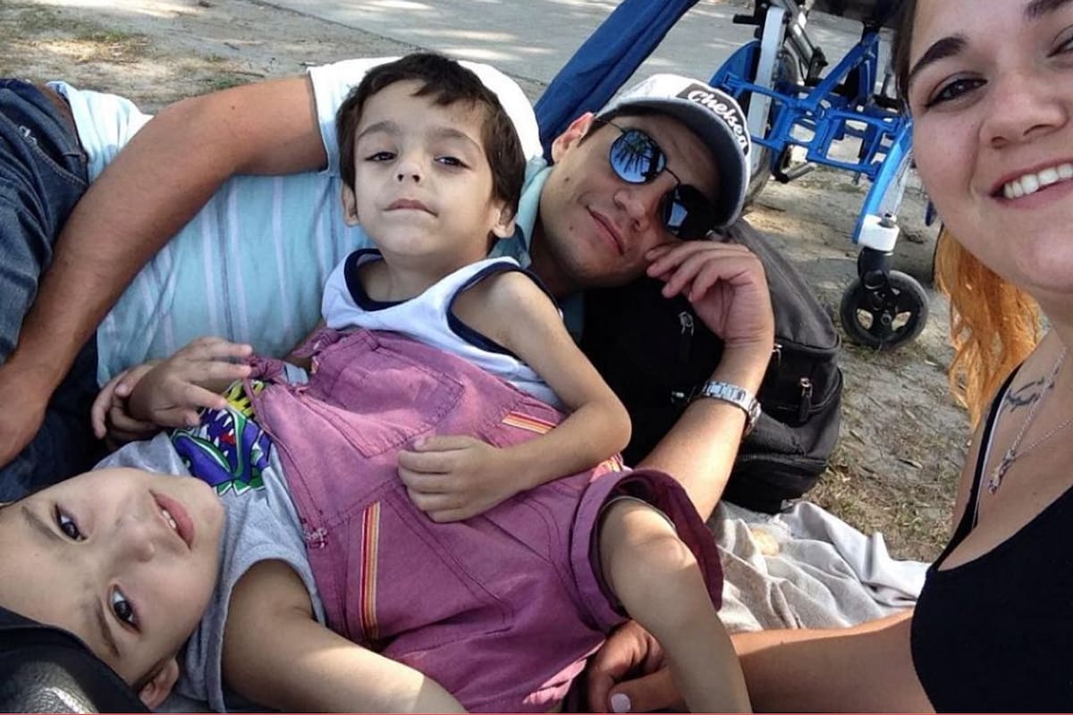 Agustín y Gael son gemelos y nacieron unidos: su separación implica muchos riesgos