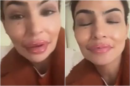 Agustina Cherri se equivocó con un filtro de Instagram y mostró un inesperado cambio en sus labios (Foto: Captura de video)