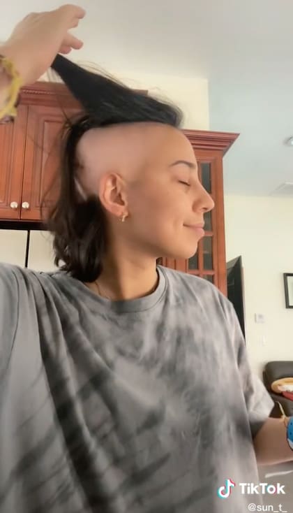Ahora sufre pérdida del cabello por las quimioterapias que recibe luego de su diagnóstico