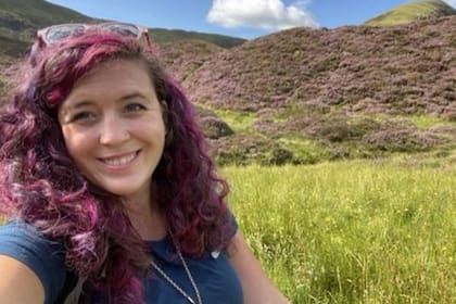 Ailsa se sometió al mismo tratamiento que la modelo Linda Evangelista