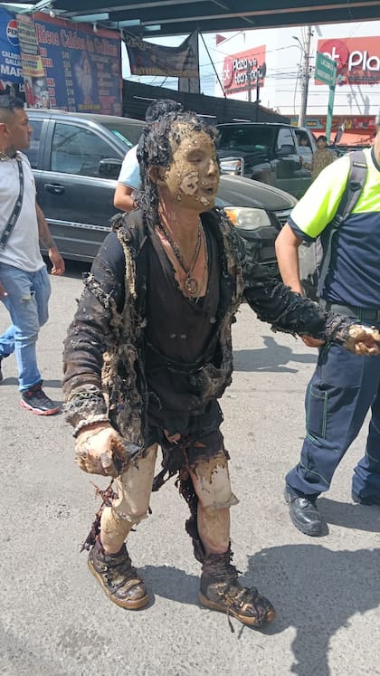 Al menos 19 personas sufrieron quemaduras de tercer grado a causa del estallido