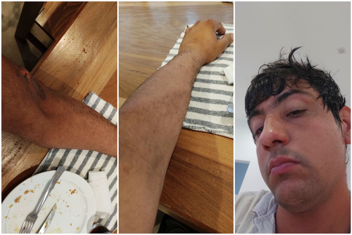 Al productor Luigi Lupi se le prendió fuego el tractor