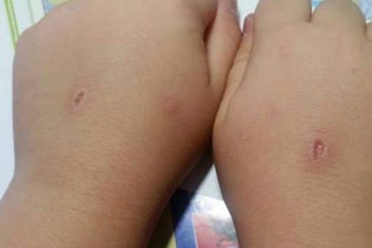 Alarma en España por un sádico juego infantil