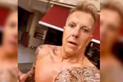 Alejandro Fantino compartió su sorpresa al ver el efecto adverso de un tratamiento al que se sometió