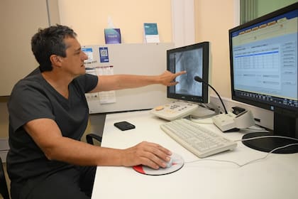 Alejandro Peirone, jefe del Departamento de Cardiología del Hospital de Niños de Córdoba, participó del procedimiento que permitió corregir una grave coartación de aorta en un bebé prematuro de 49 días de vida y 2,2 kilos