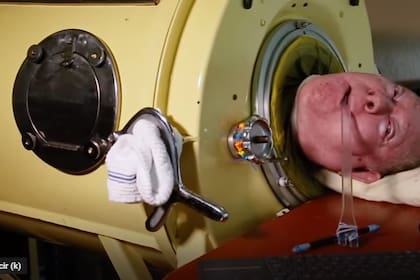 Alexander Paul vivió 70 años de su vida dentro dentro de un pulmón de acero