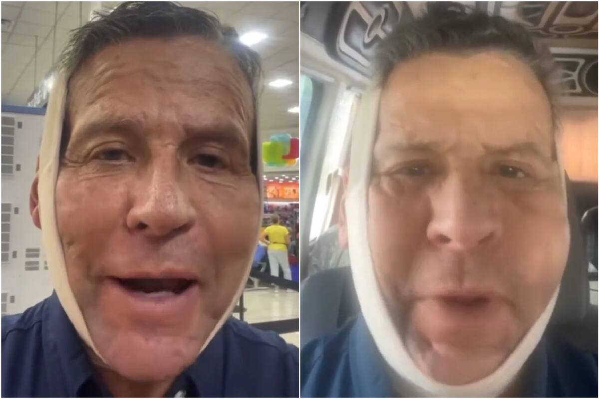 Alfredo Adame causó preocupación tras aparecer con el rostro inflamado