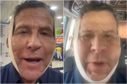 Alfredo Adame causó preocupación tras aparecer con el rostro inflamado