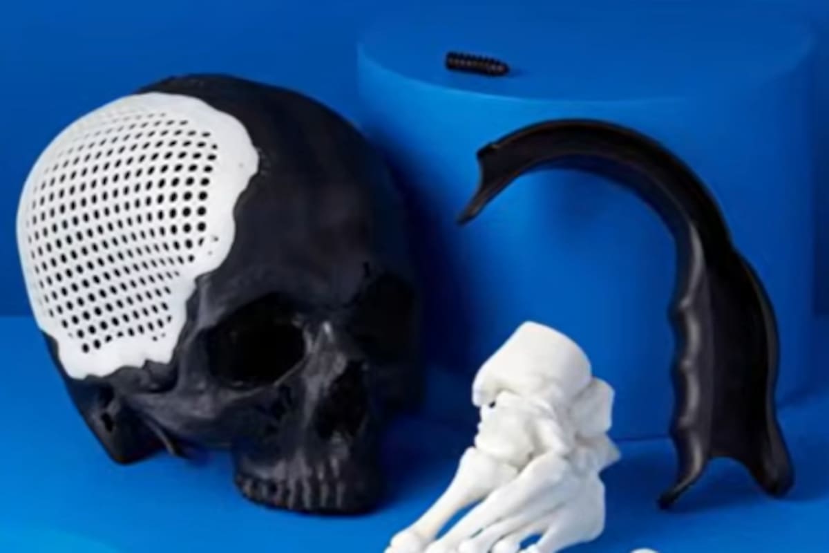 Algunas de las prótesis biodegradables para regeneración ósea