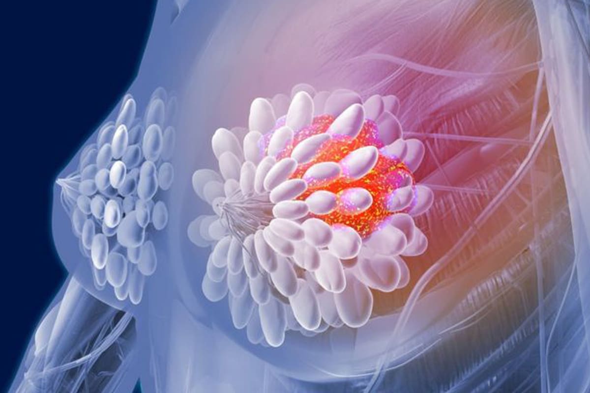 Algunas teorías sostienen que alcohol podría aumentar los niveles de ciertas hormonas que aumentan el riesgo de cáncer de mama.