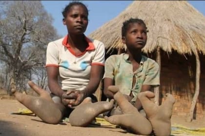 Algunos de los integrantes de la tribu Vadoma nacieron con esta extraña mutación en el gen número 7