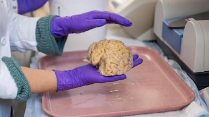 Algunos de los superancianos que participaron en el estudio donaron sus cerebros.