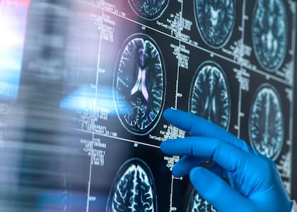 Algunos estudios indican que el yoga ayuda a mejorar la salud de nuestro cerebro al prevenir la liberación de químicos perjudiciales
