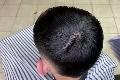 Algunos hombres no saben cómo manejarlo, pero tiene una solución (: iStock)