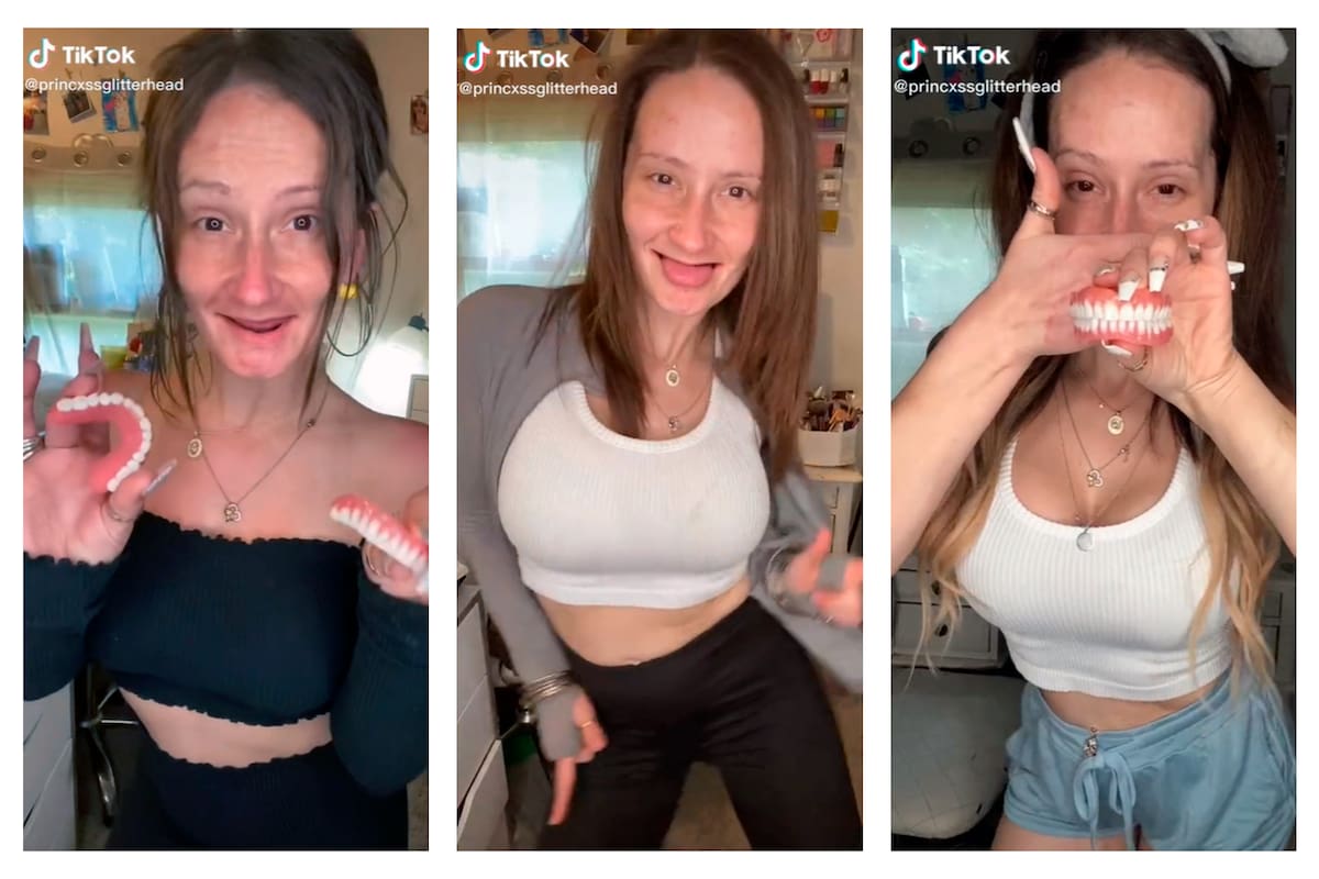 Alicia o Princess Glitterhead, como se la conoce en TikTok, utiliza las redes sociales para evitar el bullying y la discriminación a las personas que afrontan esa condición