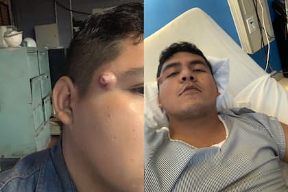 Alonso Castillo compartió toda la sorpresiva evolución de su caso, que terminó en una delicada intervención quirúrgica
