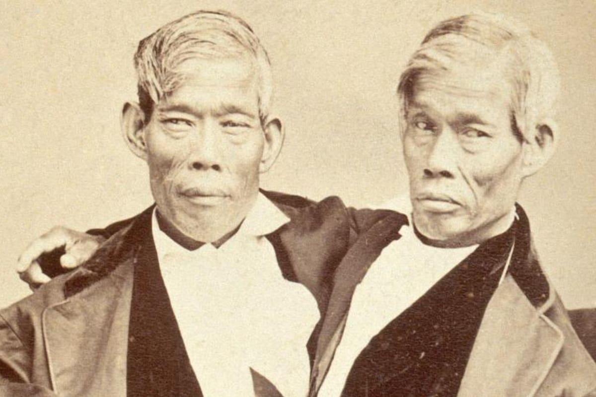 Ambos murieron con pocas horas de diferencia, debido al alcoholismo de uno de ellos. FOTO: Museo Wellcome Collection