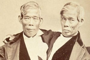 Ambos murieron con pocas horas de diferencia, debido al alcoholismo de uno de ellos. FOTO: Museo Wellcome Collection