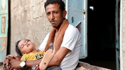 Amir "recuerda cada momento" después del bombardeo que le quitó la pierna, dice su padre.