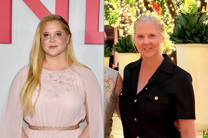 Amy Schumer protagonizó un drástico cambio de imagen