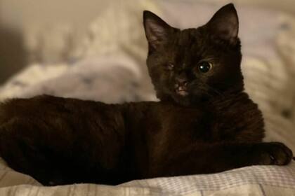 Ana tiene labio leporino y nació con un problema congénito que obligó a extirparle un ojo