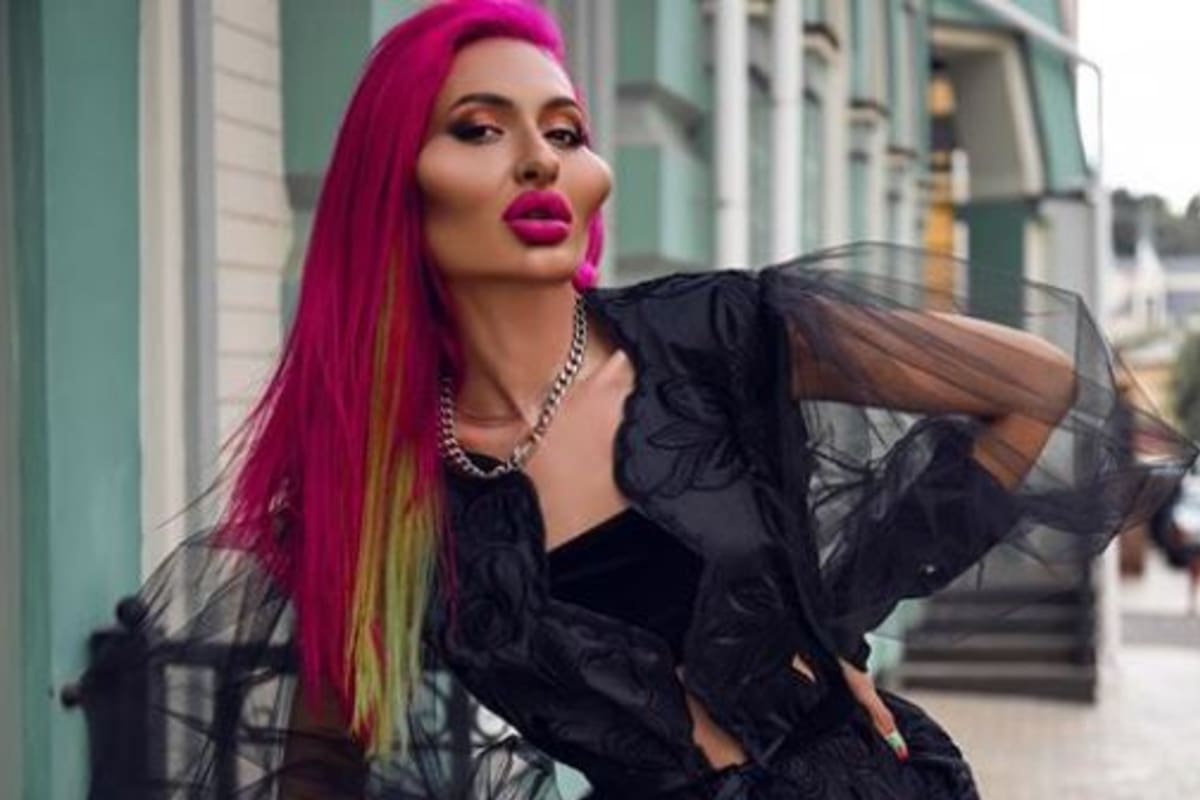 Anastasia Pokreshchuk es la influencer ucraniana que buscar ser la mujer con la mejillas más grandes del mundo. Fuente: Instagram