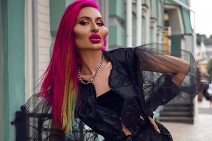 Anastasia Pokreshchuk es la influencer ucraniana que buscar ser la mujer con la mejillas más grandes del mundo. Fuente: Instagram