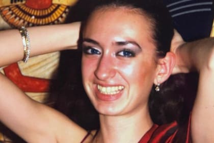 Anastasia Pokreshchuk mostró cómo cambió su rostro antes de convertirse en la mujer con los pómulos más grandes del mundo, luego de hacerse múltiples cirugías durante seis años