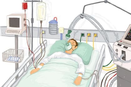 El 5 por ciento de los casos graves de infecciones con coronavirus ingresa en terapia intensiva y necesita un respirador
