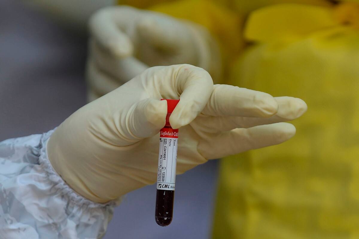 "Lograr una vacuna contra el coronavirus puede llevar años"