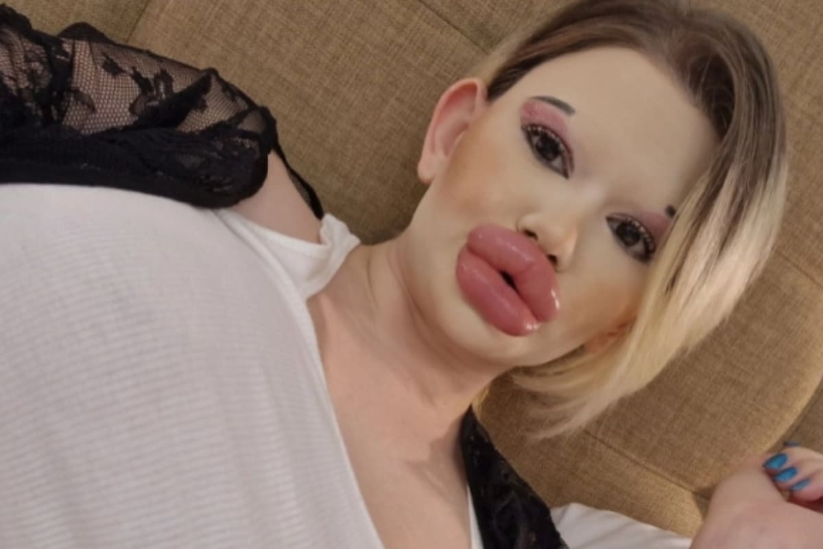 Andrea Ivanova recurrió a decenas de inyecciones de ácido hialurónico (Foto: Jam Press)