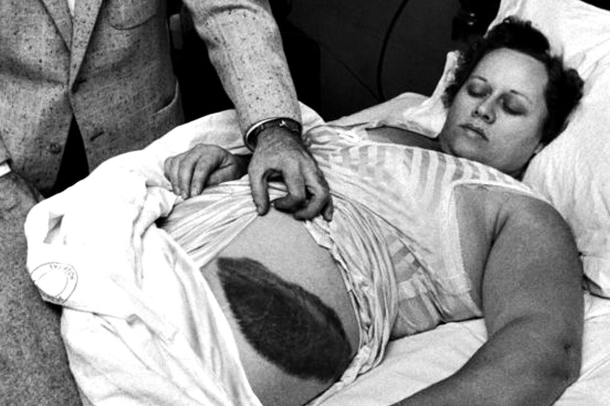 Ann Hodges sufrió un tremendo susto -y un tremendo golpe- por el meteorito, que le terminaría cambiando la vida
