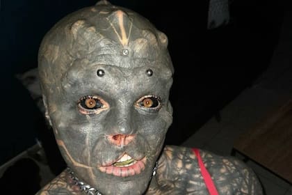 Anthony Loffredo llevó su transformación al extremo de quitarse la punta de la nariz y la parte superior de su boca, lo que le generó problemas para articular palabras