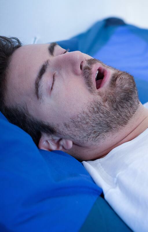 Apnea Obstructiva del Sueño