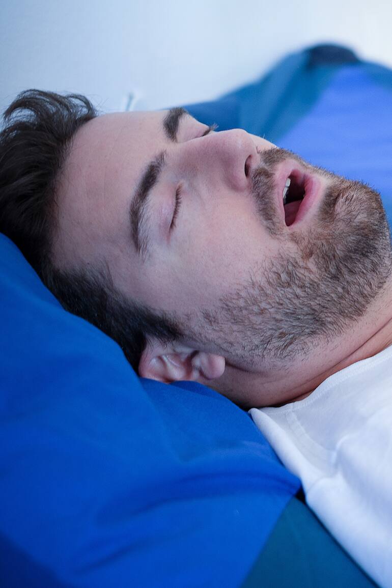 Apnea Obstructiva del Sueño