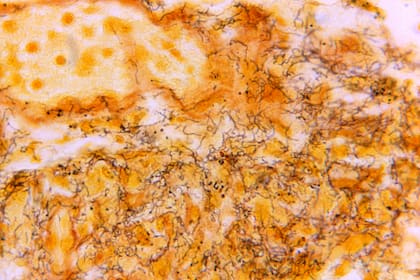 ARCHIVO - En esta fotografía de microscopio de 1966 distribuida por los Centros para el Control y la Prevención de Enfermedades de EEUU se ve una muestra de tejido con la presencia de espiroquetas Treponema pallidum, la bacteria responsable de la sífilis. (Skip Van Orden/CDC vía AP, Archivo)
