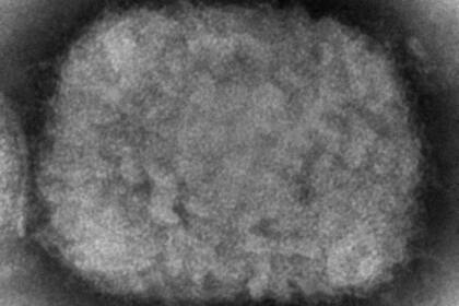 ARCHIVO - Esta imagen de microscopio electrónico de 2003 facilitada por los Centros para el Control y la Prevención de Enfermedades muestra un virión de viruela símica, obtenido de una muestra asociada al brote de perros de la pradera de 2003. Cynthia S. Goldsmith, Russell Regner/CDC vía AP, Archivo)