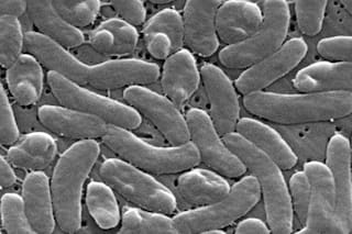 Autoridades de salud de EE.UU. alertan a bañistas de bacteria carnívora en aguas costeras