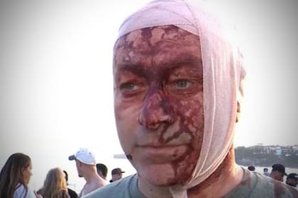 Arsen Ostrovsky sobrevivió a dos atentados antisemitas. Foto: captura Canal 9 Australia