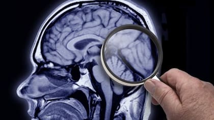Aseguran que ésta no había podido ser observada antes porque se desintegra cuando se extrae el cerebro del cráneo en las autopsias.