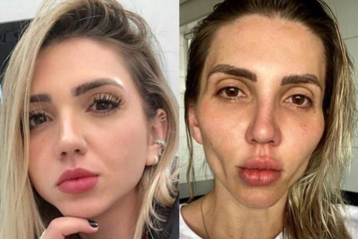 Así era la influencer antes y así quedó después