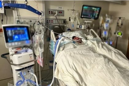 Así estaba el joven en el hospital luego de quemarse por seguir un reto viral