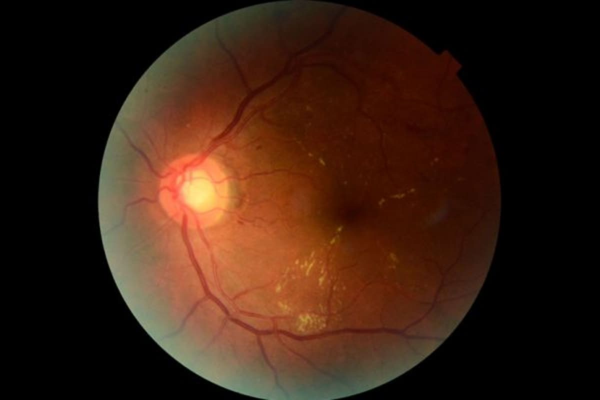 Así funciona la IA del Conicet que puede detectar a tiempo daños en la retina provocados por la diabetes (Foto: CONICET)
