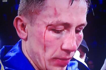 Así quedaron los rostros de Canelo y Golovkin tras la pelea