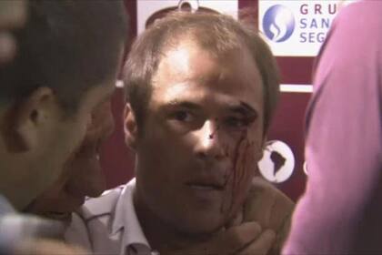 Así quedó el jugador de Lanús