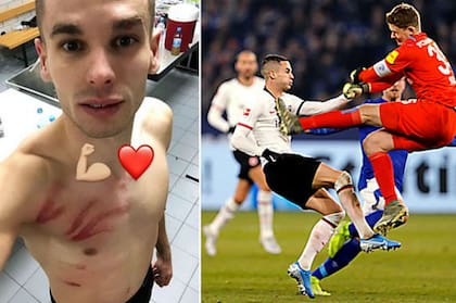 Así quedó el pecho de Mijat Gacinovic