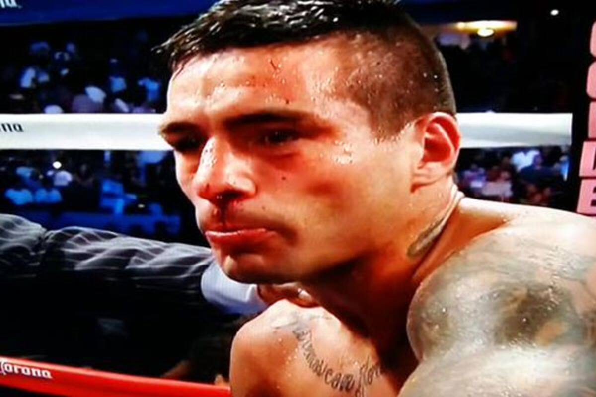 Así quedó el rostro de Matthysse