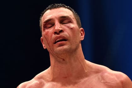 Así quedó el rostro de Klitschko tras le derrota